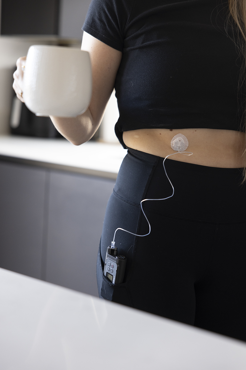 Your role in Insulin Pump Therapy